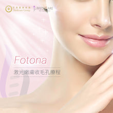 將圖片載入圖庫檢視器 Fotona 收毛孔嫩膚激光療程

